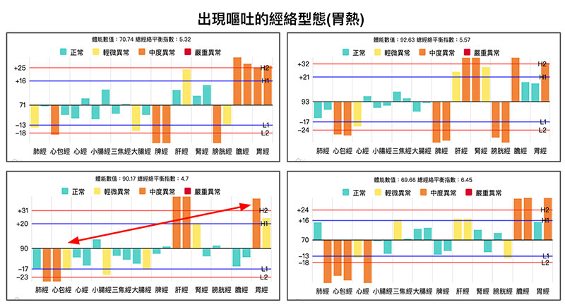 胃熱嘔吐經絡型態，可見胃經實證，心包經虛證