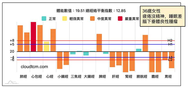 腦下垂體良性腫瘤案例
