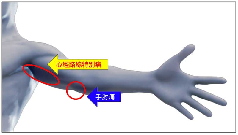 高爾夫球肘痛，在心經路線上特別疼痛