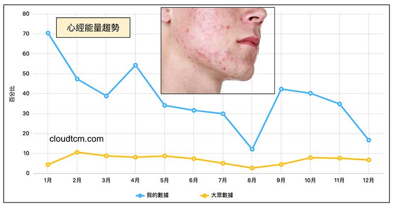 長年心經能量大於大眾，滿臉青春痘