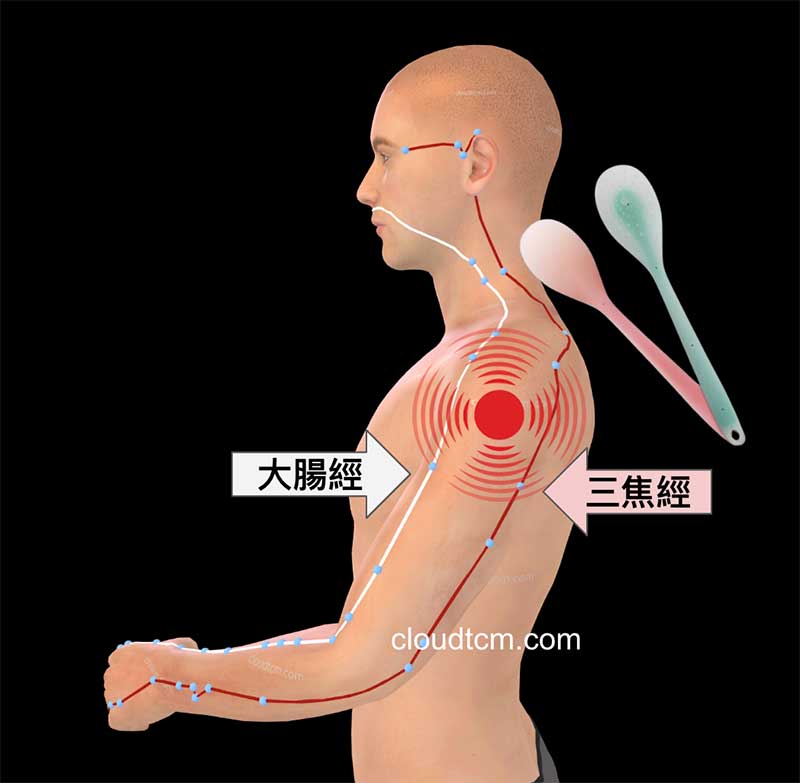 位於上臂的疼痛點與三焦經、大腸經有關