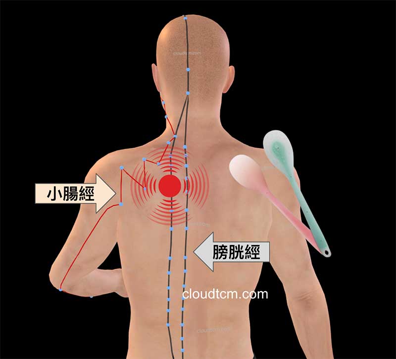 拍打小腸經與膀胱經交接處較疼痛