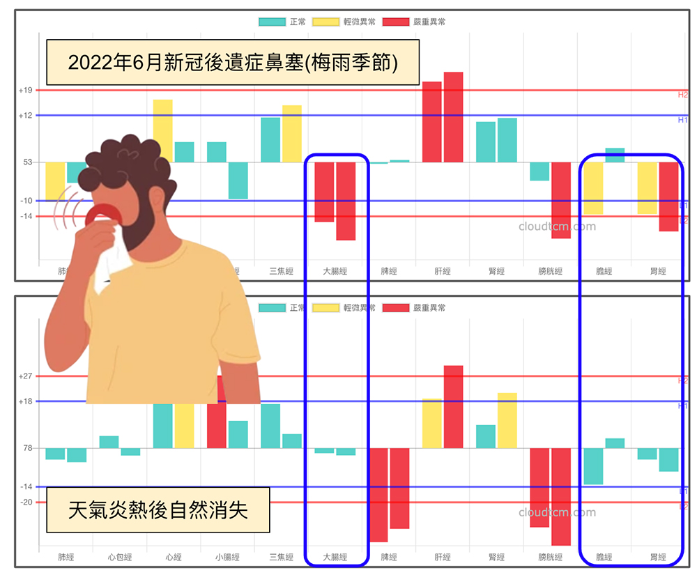 新冠後遺症的鼻塞，隨著天氣炎熱後自然消失