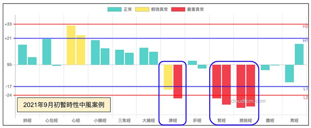 暫時性中風經絡