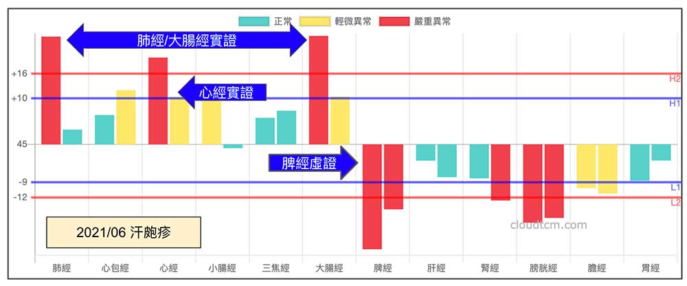 汗皰疹經絡現象