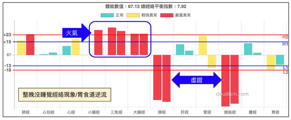 熬夜沒睡覺之後造成胃食道逆流