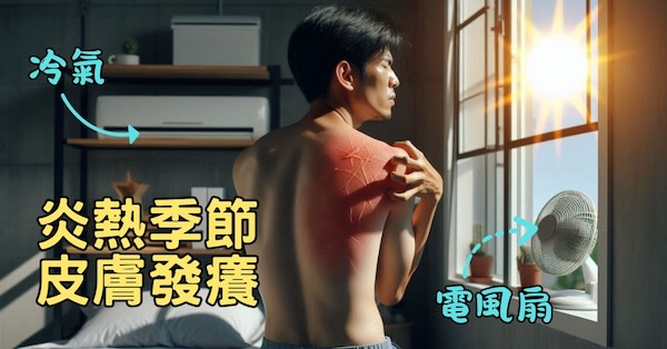 在炎熱季節下，特別容易出現皮膚搔癢