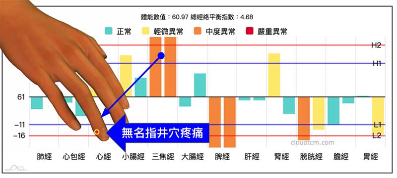 三焦經出現實證的時候，無名指的井穴有機會出現疼痛