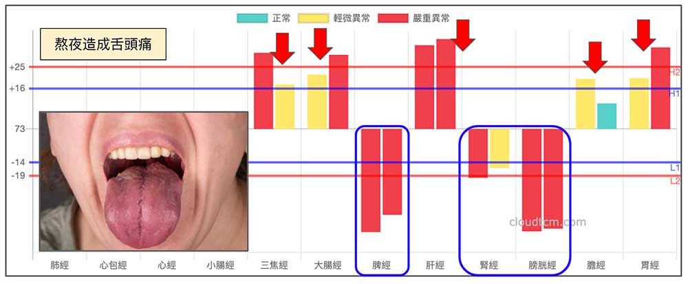 熬夜舌頭痛