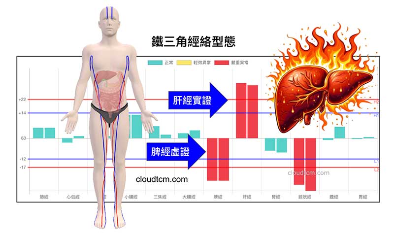 現代人常見的鐵三角經絡型態，源自於肝臟與肝經