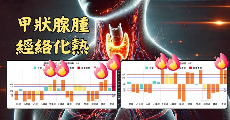甲狀腺腫的人，經絡通常是化熱的狀態