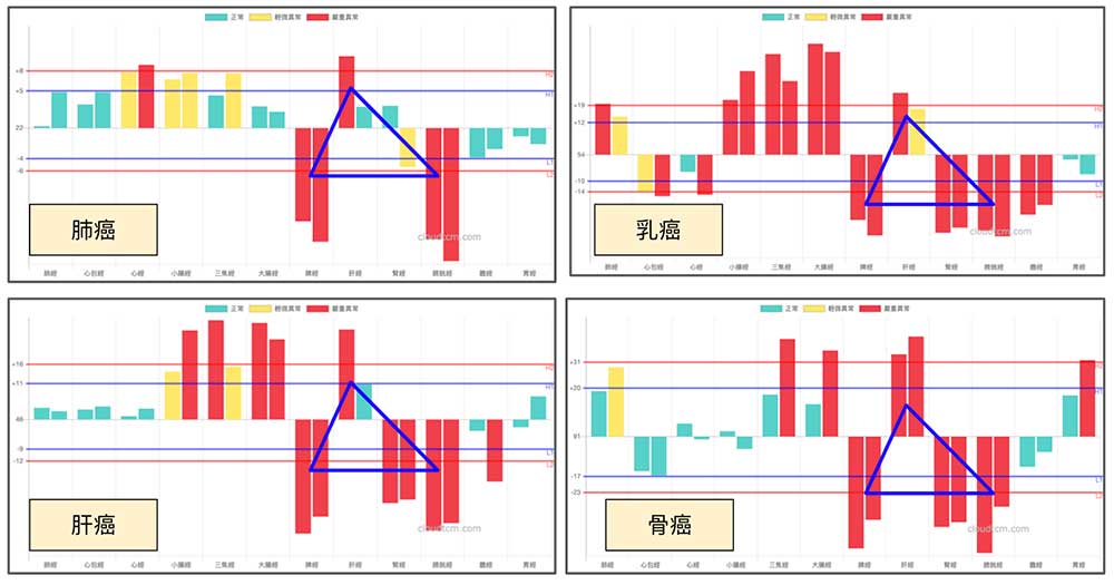鐵三角經絡型態與癌症