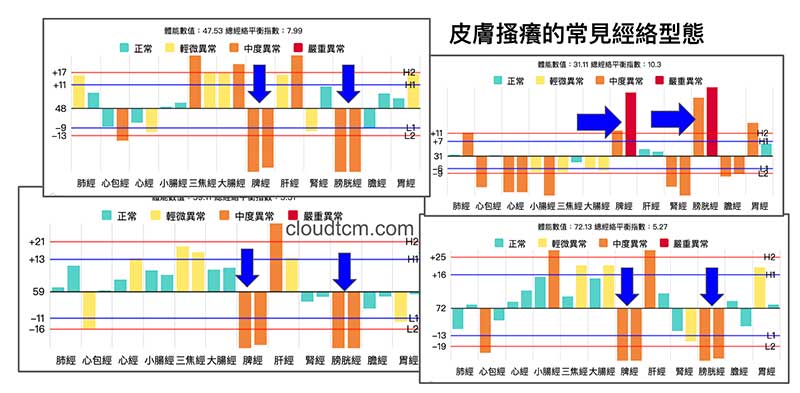 皮膚搔癢常見的經絡型態