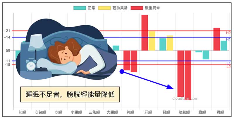 睡眠不足的人容易出現鐵三角經絡型態