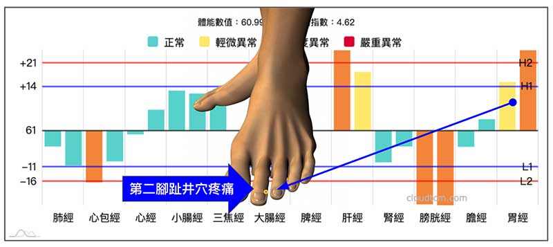 胃經實證時，第二腳趾井穴附近容易出現疼痛