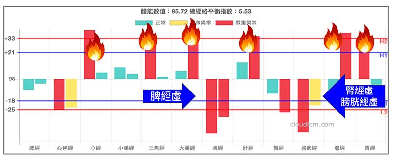 糖尿病化熱的鐵三角經絡型態