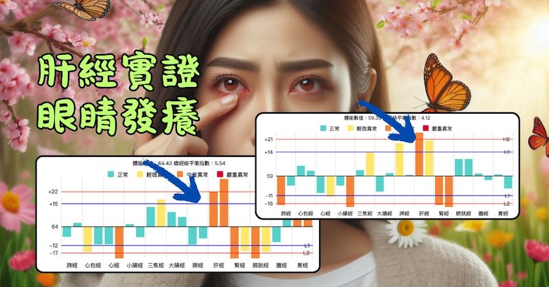 肝經出現實證時，很容易眼睛發癢