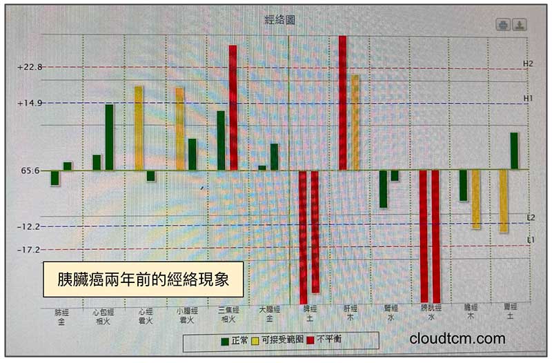 胰臟癌經絡現象