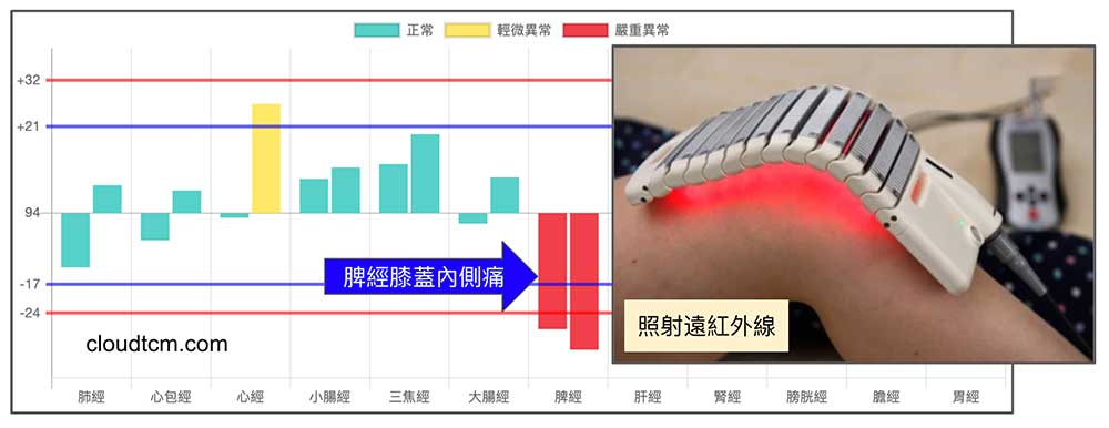 遠紅外線照射脾經，改善膝蓋痛