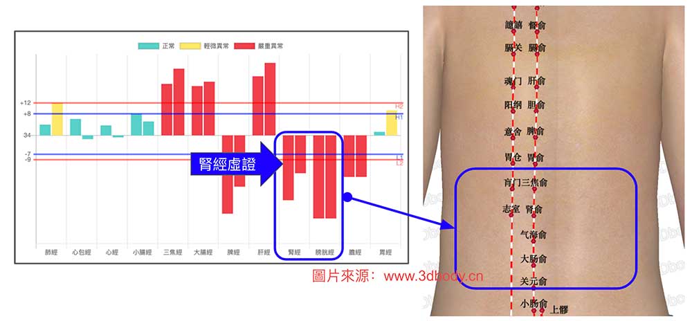 腎經虛證會造成腰酸的經絡現象
