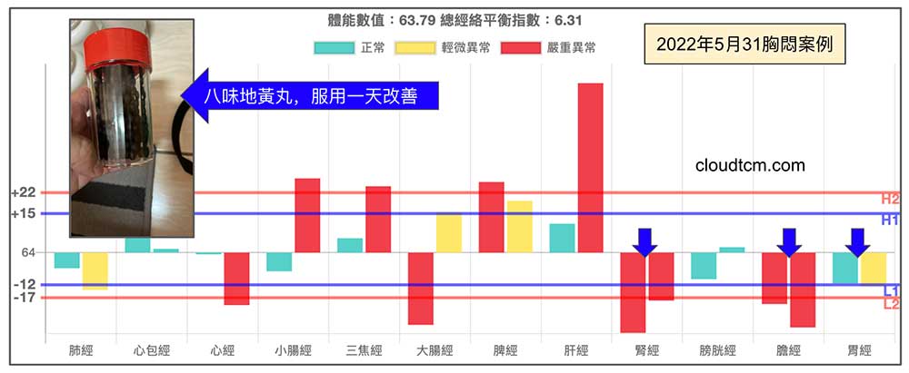 腎陽虛胸悶氣喘，服用八味地黃丸快速改善！