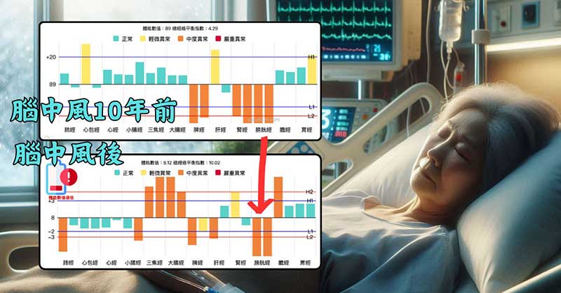 腦中風10年前，膀胱經就已經長期虛證
