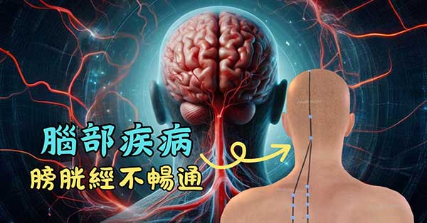 膀胱經不暢通的人，容易罹患腦部疾病