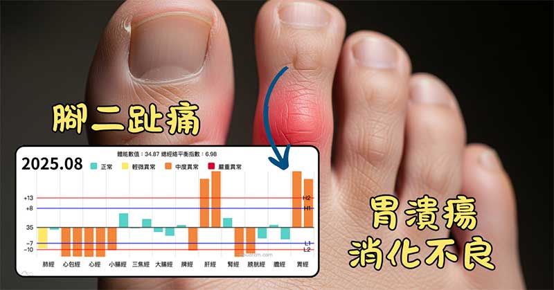 炎熱夏季胃經實證，出現胃潰瘍消化不良，第二腳趾痛的現象