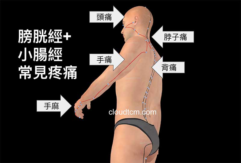 膀胱經＋小腸經氣血不足出現的疼痛部位