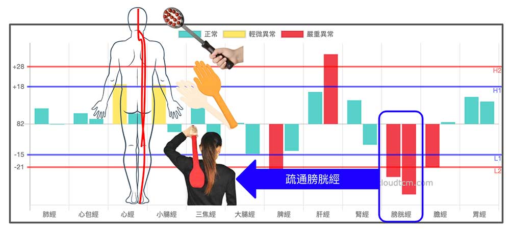 拍打膀胱經