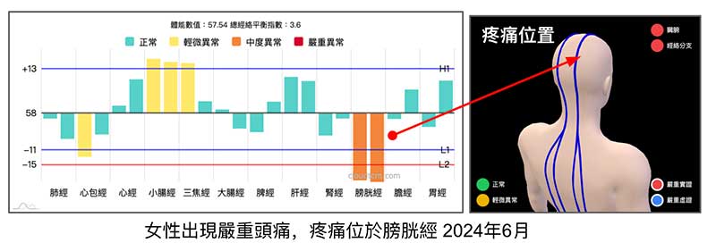 女性出現嚴重頭痛，位於膀胱經上