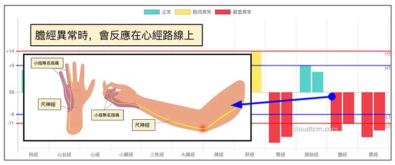 膽經異常的時候，也會反映在心經路線上