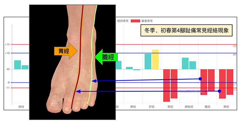 冬季及初春的時候，膽經胃經虛證出現第三第四腳趾痛