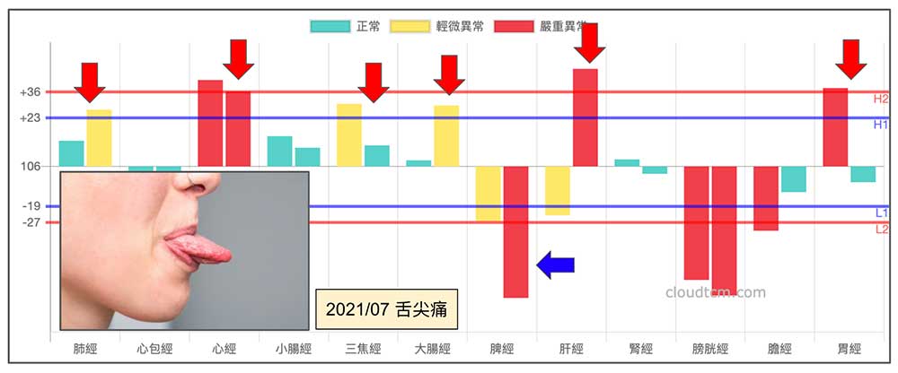 舌頭痛案例