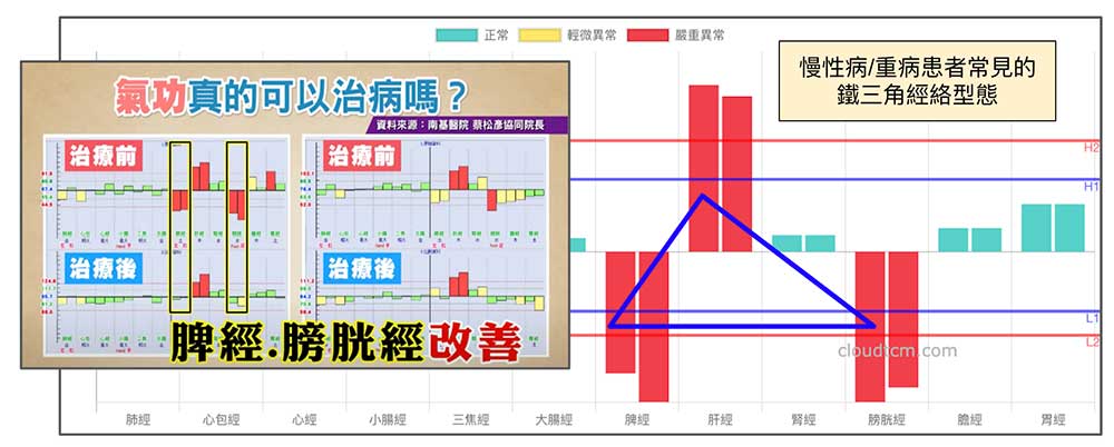 久病重病患者的經絡型態，通常僵固不變