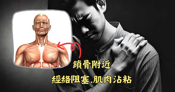 鎖骨附近經絡組塞，肌肉沾粘容易出現疼痛