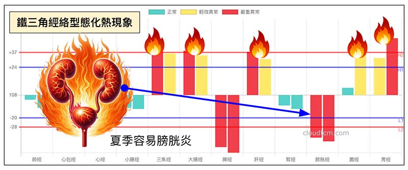 夏季鐵三角經絡型態，體內火氣大容易出現膀胱炎