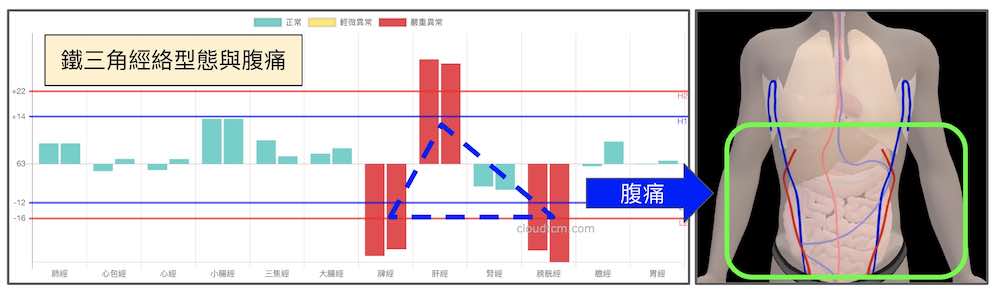 鐵三角經絡型態容易出現腹痛，腸道疾病