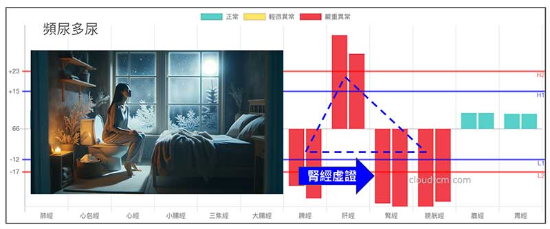 鐵三角經絡型態也會出現腎經虛證