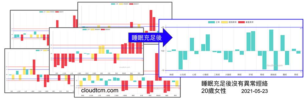 居家隔離睡眠充足