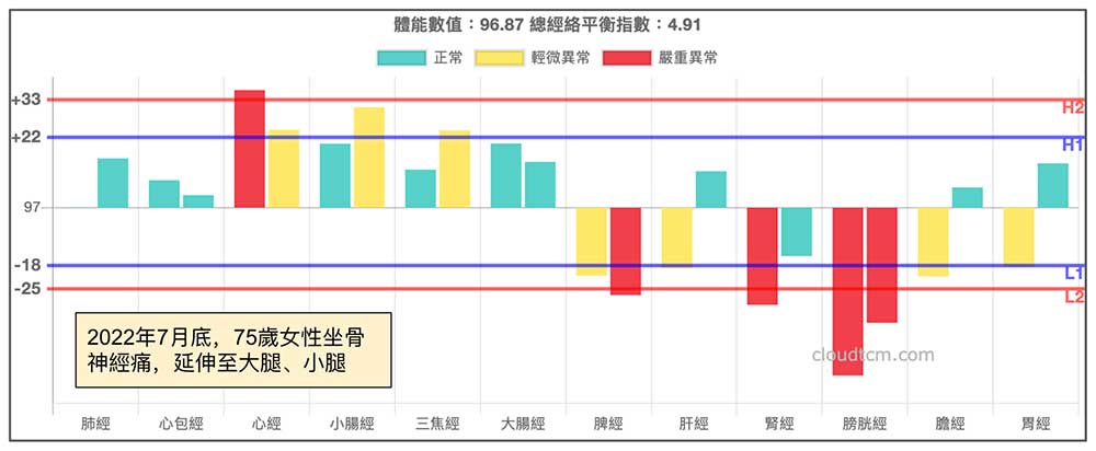 2022年7月底，75歲女性坐骨神經痛復發