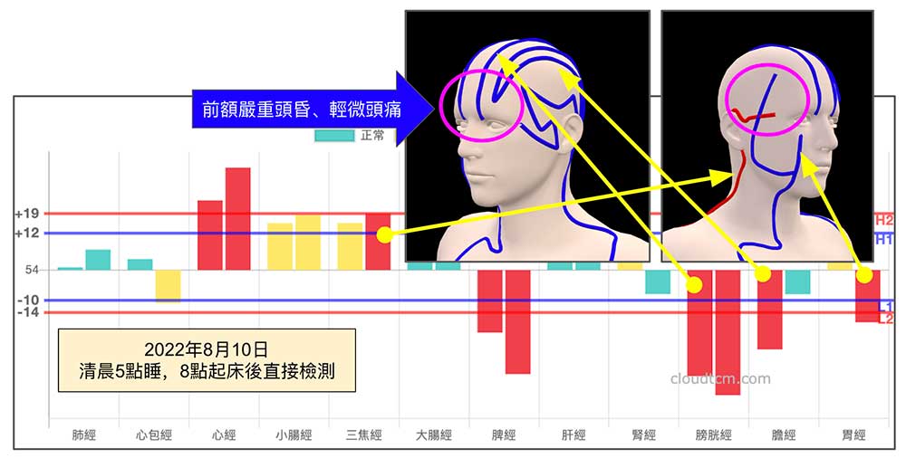 熬夜嚴重睡眠不足，前額頭昏頭痛的經絡現象