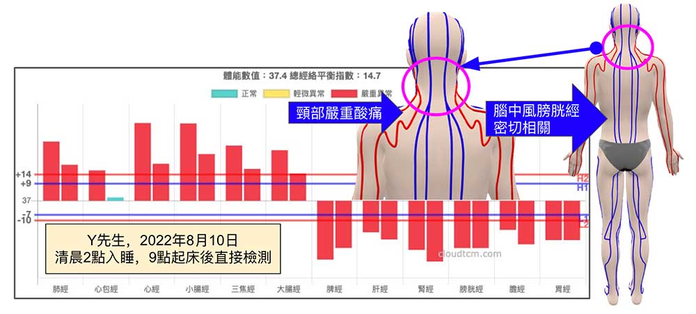 2022年8月熬夜後頸部嚴重緊痛