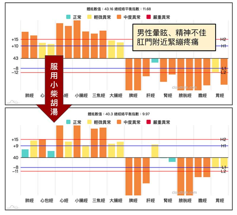 男性暈眩，精神不佳且肛門痛，服用小柴胡湯緩解