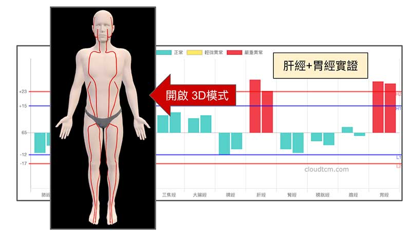 嚴重實證經絡以紅色經絡路線顯示